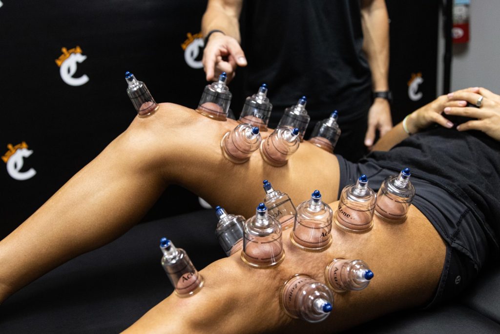 dry needling treatment