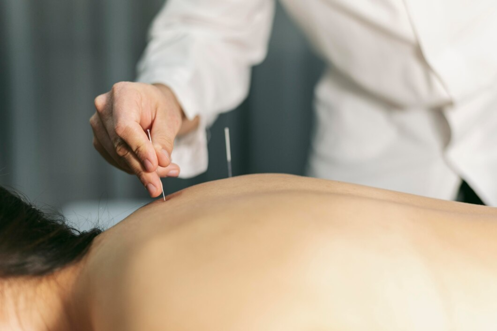 Dry Needling